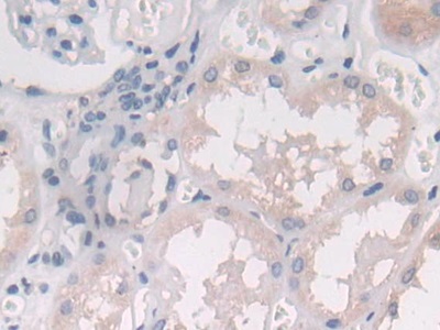 Polyclonal Antibody to Interleukin 25 (IL25)