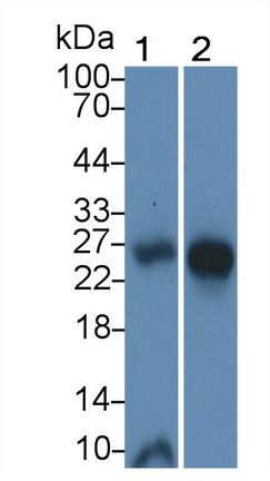 Polyclonal Antibody to Interleukin 25 (IL25)