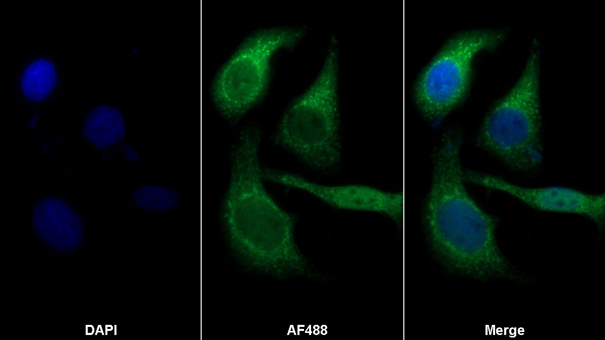 Polyclonal Antibody to Vascular Endothelial Growth Factor 165 (VEGF165)