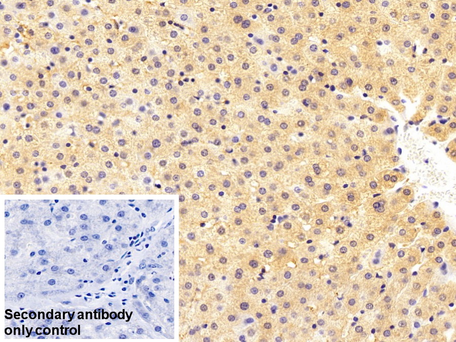 Polyclonal Antibody to Alpha-1-Antitrypsin (a1AT)