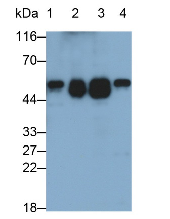 Polyclonal Antibody to Alpha-1-Antitrypsin (a1AT)