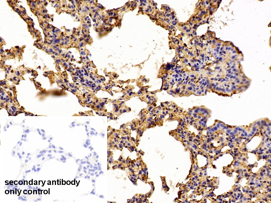 Polyclonal Antibody to Alpha-1-Antitrypsin (a1AT)