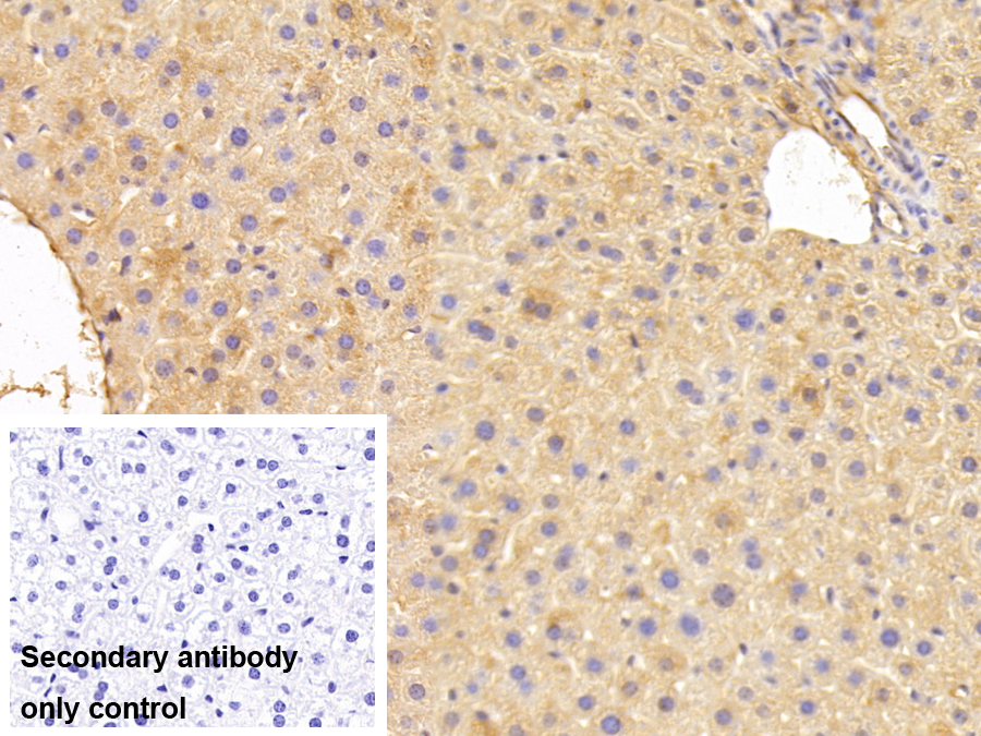 Polyclonal Antibody to Alpha-1-Antitrypsin (a1AT)