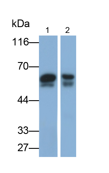 Polyclonal Antibody to Alpha-1-Antitrypsin (a1AT)