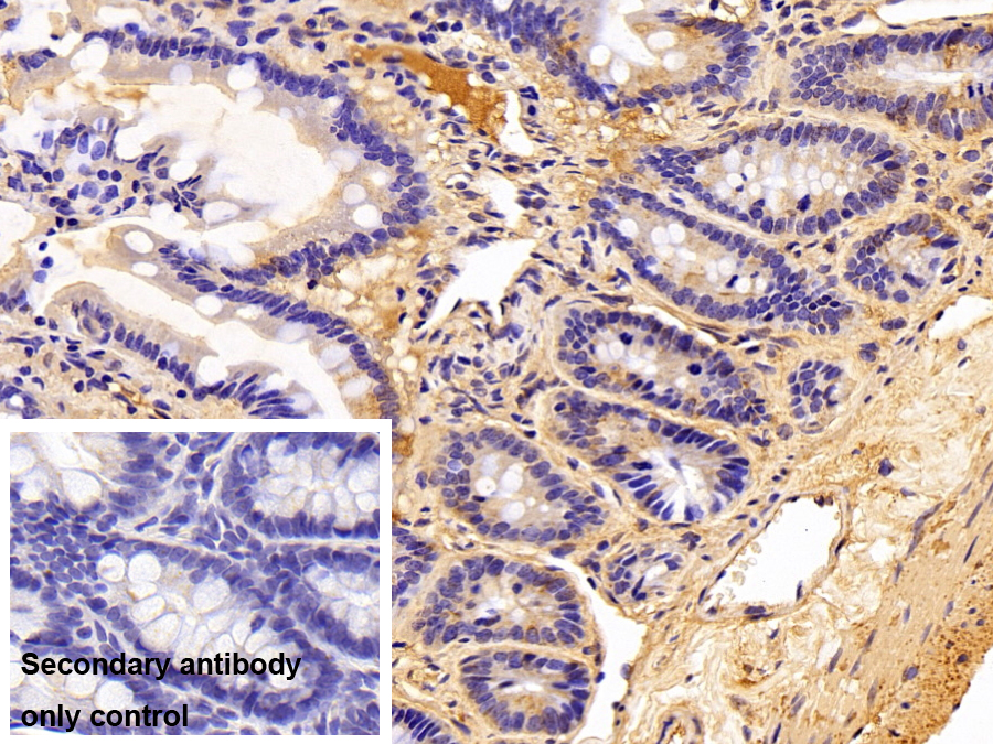 Polyclonal Antibody to Alpha-1-Antitrypsin (a1AT)