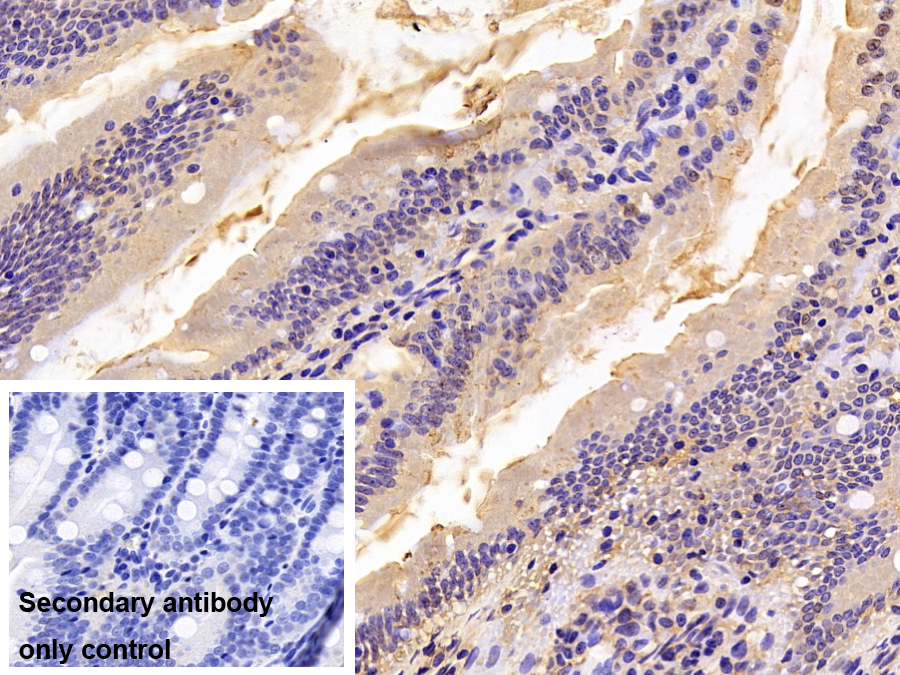 Polyclonal Antibody to Alpha-1-Antitrypsin (a1AT)