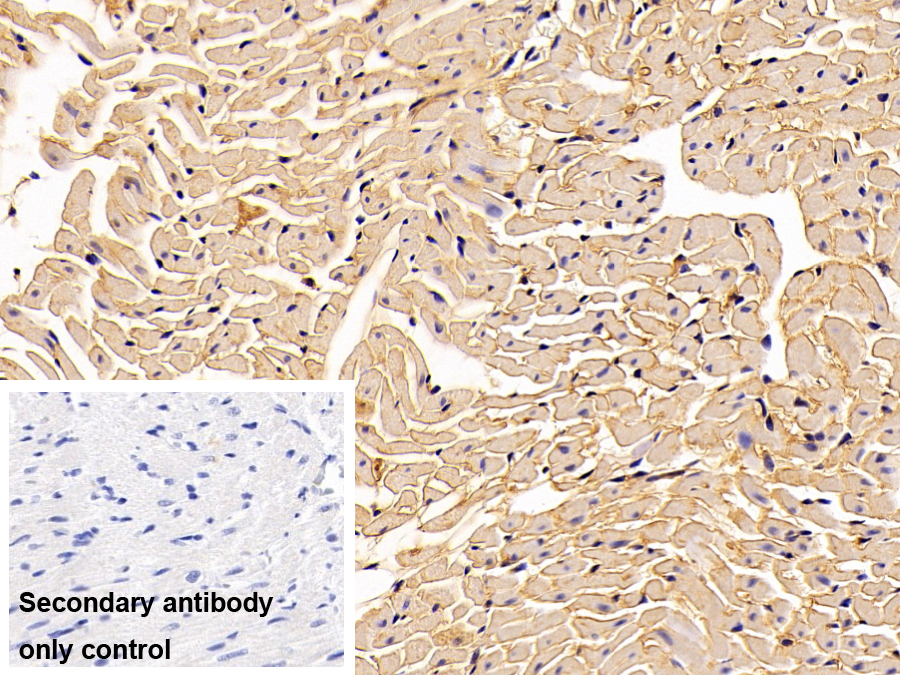 Polyclonal Antibody to Alpha-1-Antitrypsin (a1AT)