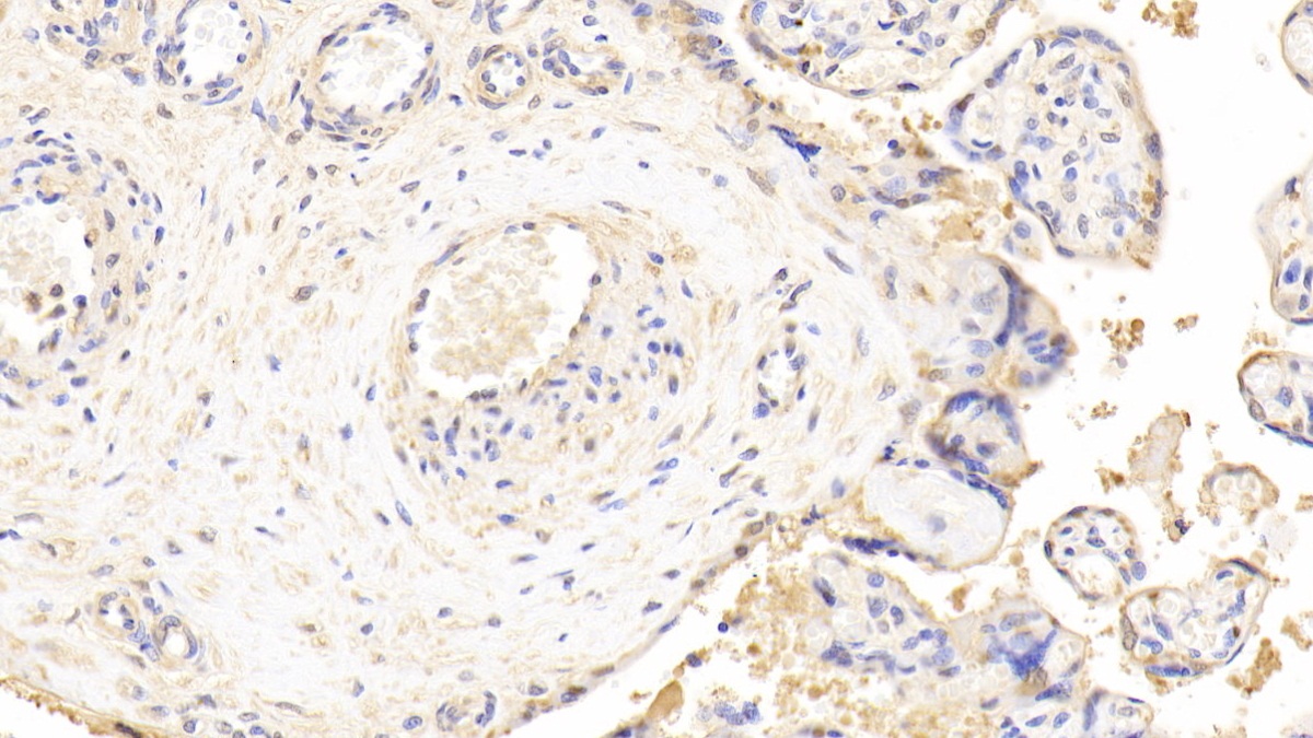 Polyclonal Antibody to Lactate Dehydrogenase B (LDHB)