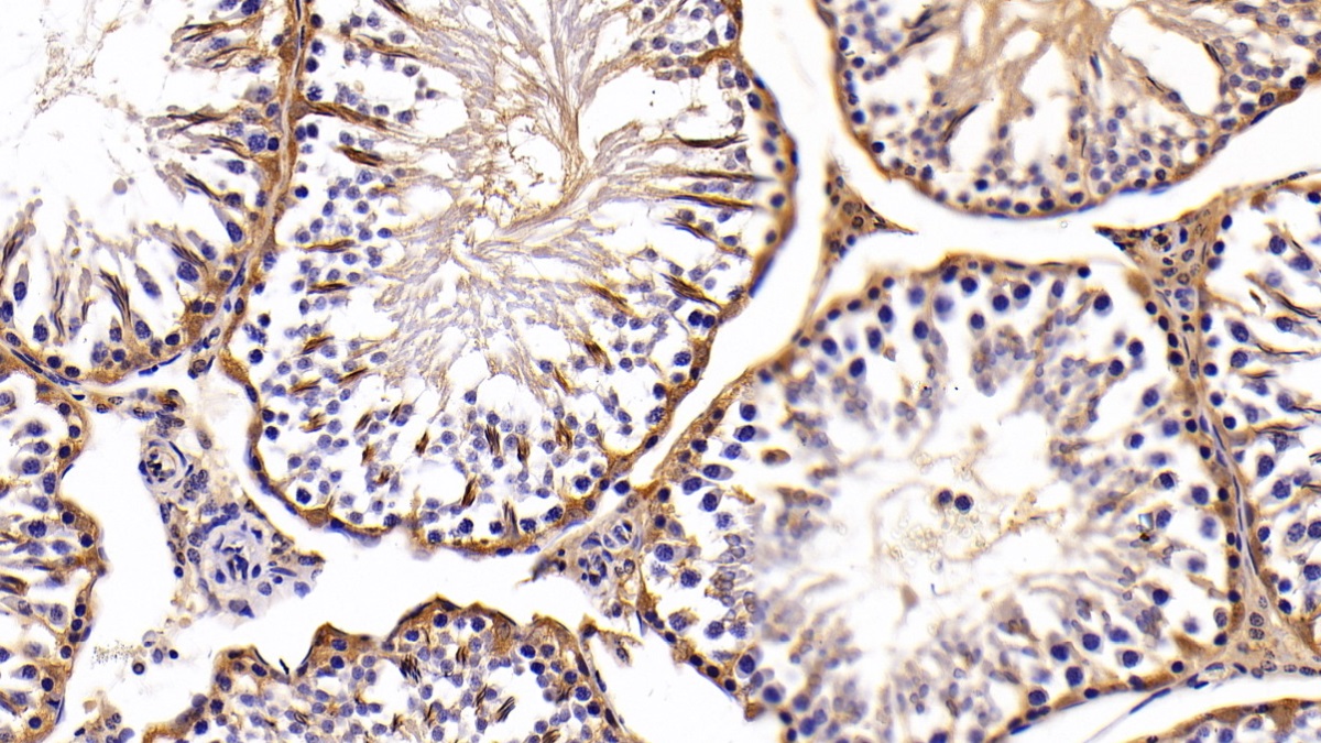 Polyclonal Antibody to Lactate Dehydrogenase B (LDHB)