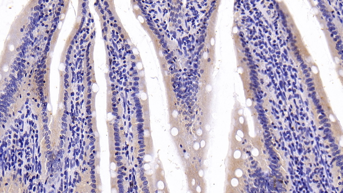 Polyclonal Antibody to Lactate Dehydrogenase B (LDHB)