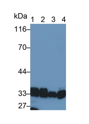 Polyclonal Antibody to Lactate Dehydrogenase B (LDHB)