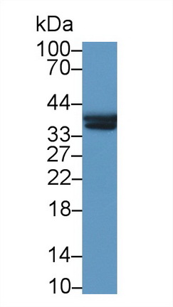 Polyclonal Antibody to Lactate Dehydrogenase B (LDHB)