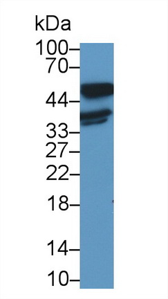 Polyclonal Antibody to Lactate Dehydrogenase B (LDHB)