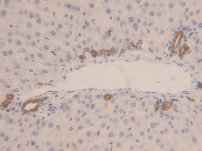 Polyclonal Antibody to Lactate Dehydrogenase B (LDHB)