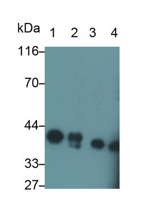 Polyclonal Antibody to Lactate Dehydrogenase B (LDHB)