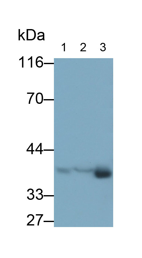 Polyclonal Antibody to Lactate Dehydrogenase B (LDHB)