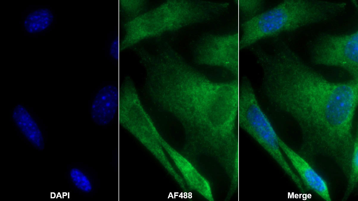 Polyclonal Antibody to Lactate Dehydrogenase B (LDHB)