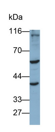 Polyclonal Antibody to Angiopoietin Like Protein 3 (ANGPTL3)