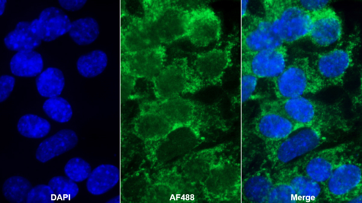 Polyclonal Antibody to Angiopoietin Like Protein 3 (ANGPTL3)