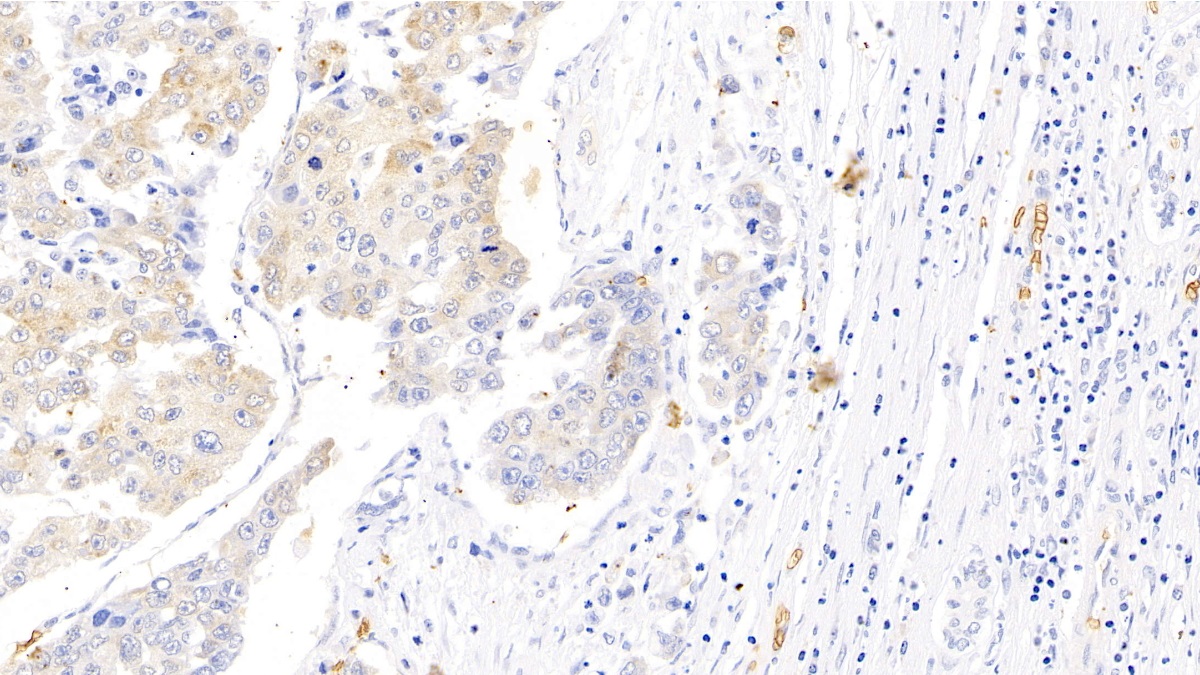 Polyclonal Antibody to Glycophorin A (GYPA)