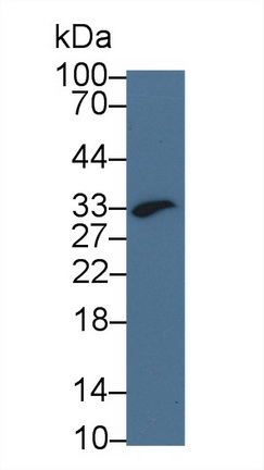 Polyclonal Antibody to Glycophorin A (GYPA)