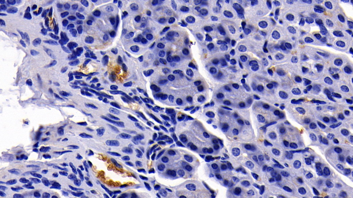 Polyclonal Antibody to Glycophorin A (GYPA)