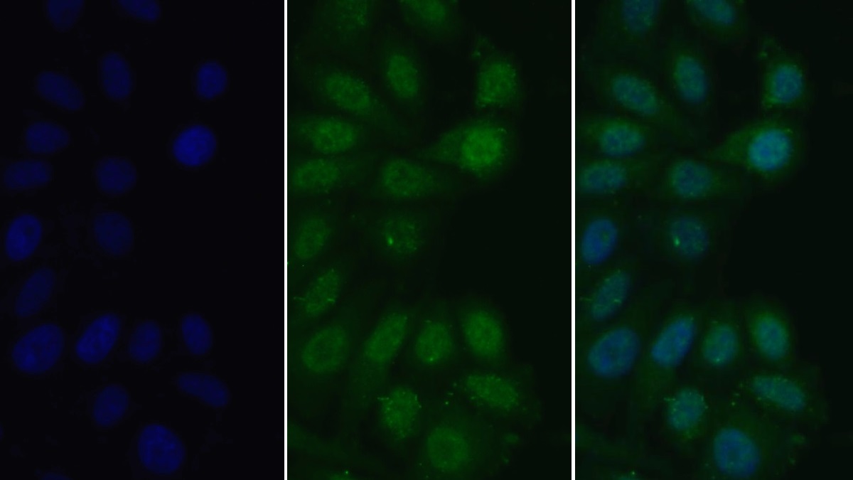 Polyclonal Antibody to Myeloid Differentiation Factor 88 (MyD88)