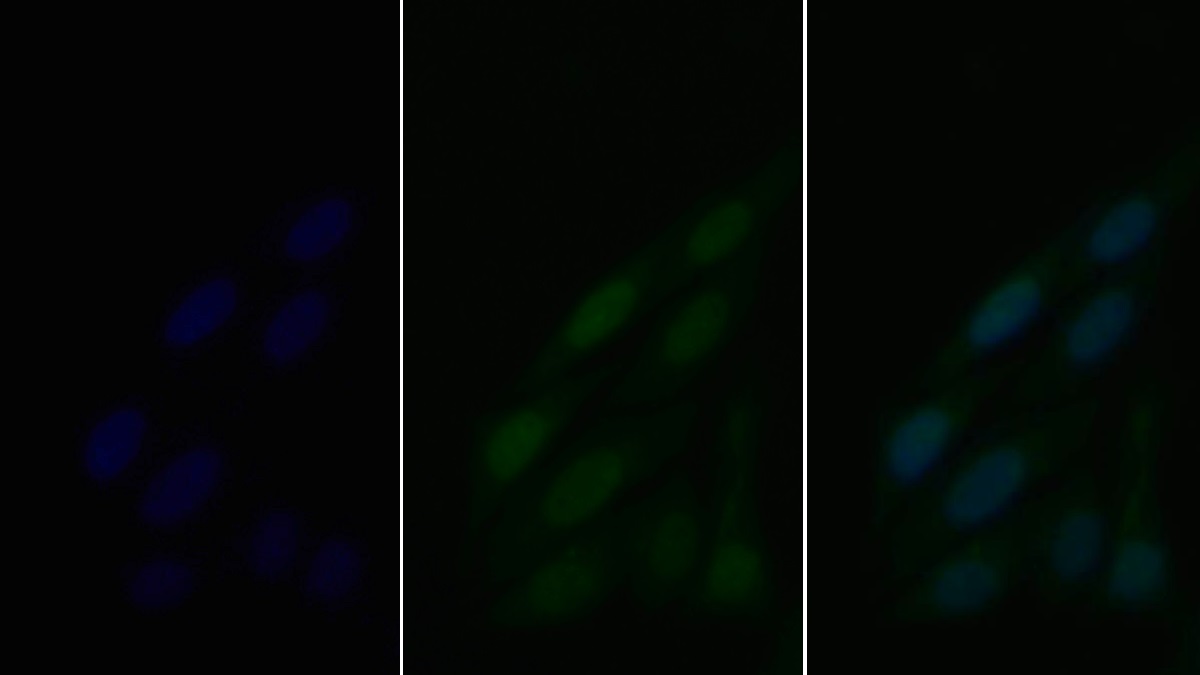 Polyclonal Antibody to Myeloid Differentiation Factor 88 (MyD88)