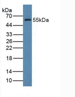 Polyclonal Antibody to Farnesyl Diphosphate Farnesyltransferase 1 (FDFT1)