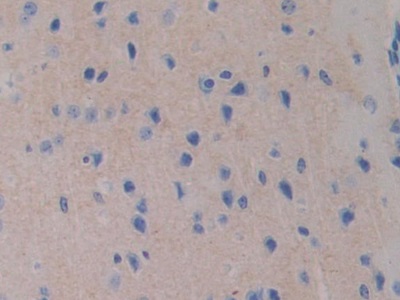 Polyclonal Antibody to Farnesyl Diphosphate Farnesyltransferase 1 (FDFT1)