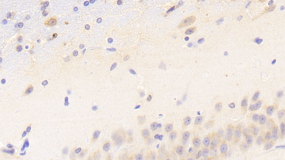 Polyclonal Antibody to Farnesyl Diphosphate Farnesyltransferase 1 (FDFT1)