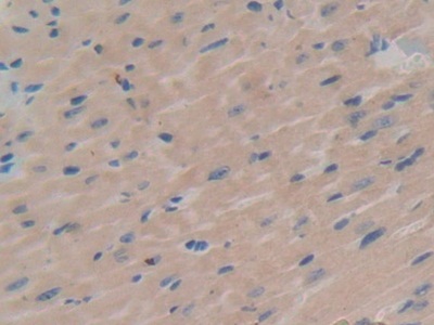 Polyclonal Antibody to Serum/Glucocorticoid Regulated Kinase 1 (SGK1)