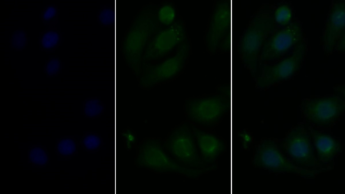 Polyclonal Antibody to Mitogen Activated Protein Kinase Kinase 6 (MAP2K6)