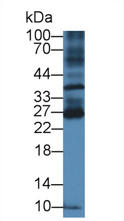 Polyclonal Antibody to B And T-Lymphocyte Attenuator (BTLA)