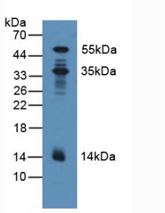 Polyclonal Antibody to Pyridoxal Kinase (PDXK)