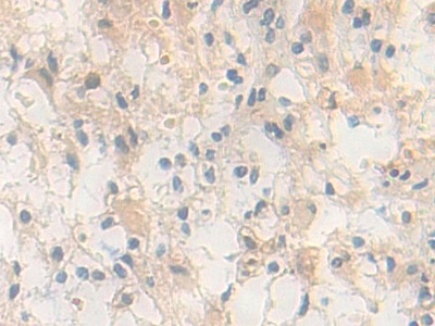 Polyclonal Antibody to Pyridoxal Kinase (PDXK)