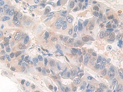 Polyclonal Antibody to Pyridoxal Kinase (PDXK)