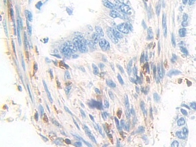 Polyclonal Antibody to Pyridoxal Kinase (PDXK)