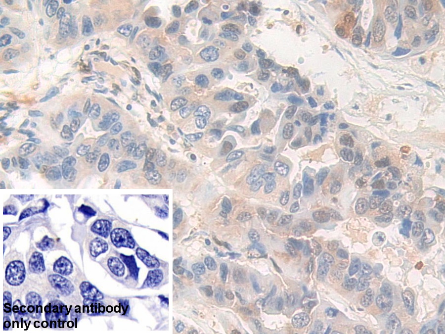 Polyclonal Antibody to Pyridoxal Kinase (PDXK)