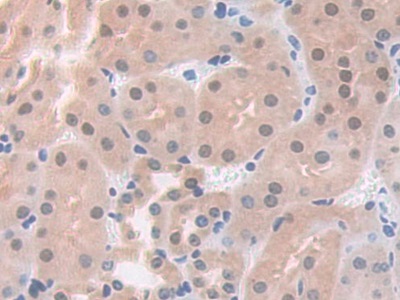 Polyclonal Antibody to Pyridoxal Kinase (PDXK)