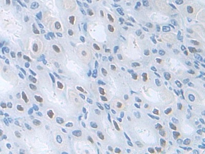 Polyclonal Antibody to Pyridoxal Kinase (PDXK)