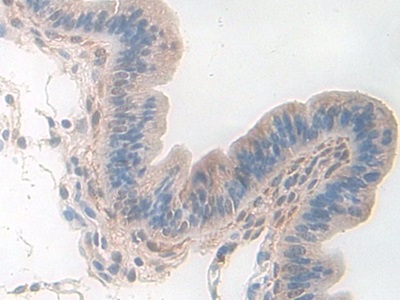 Polyclonal Antibody to Pyridoxal Kinase (PDXK)