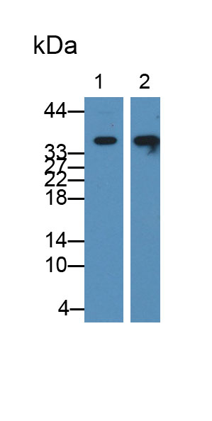 Polyclonal Antibody to Pyridoxal Kinase (PDXK)