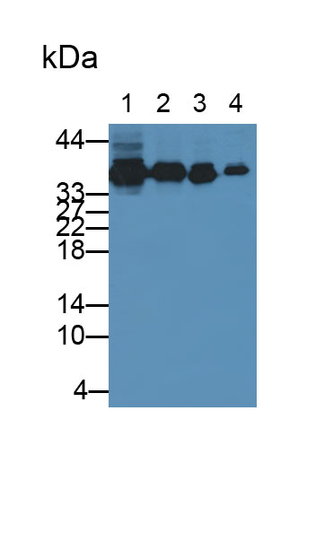 Polyclonal Antibody to Pyridoxal Kinase (PDXK)