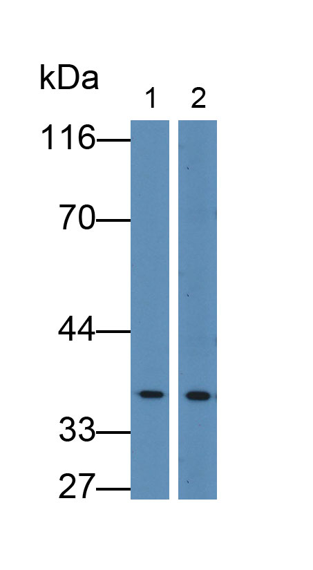 Polyclonal Antibody to Pyridoxal Kinase (PDXK)