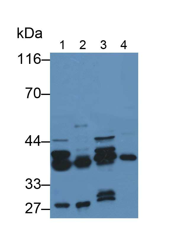 Polyclonal Antibody to Pyridoxal Kinase (PDXK)