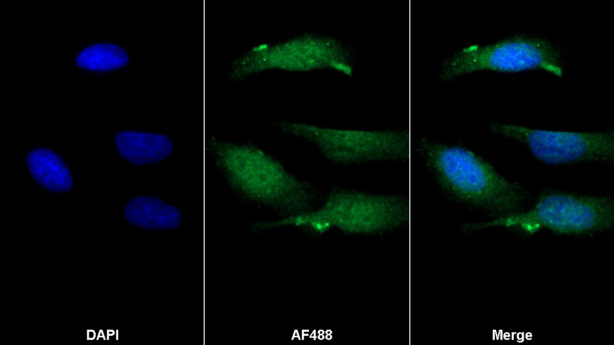 Polyclonal Antibody to Pyridoxal Kinase (PDXK)