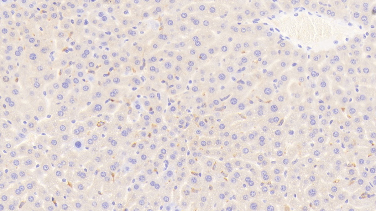 Polyclonal Antibody to Cluster Of Differentiation (CD163)