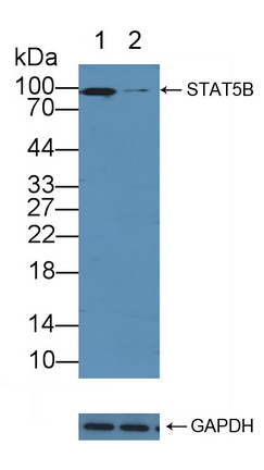 Polyclonal Antibody to Signal Transducer And Activator Of Transcription 5B (STAT5B)