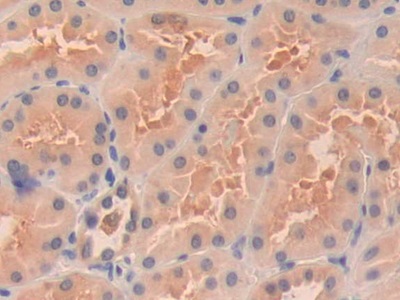 Polyclonal Antibody to Oncoprotein Induced Transcript 3 (OIT3)